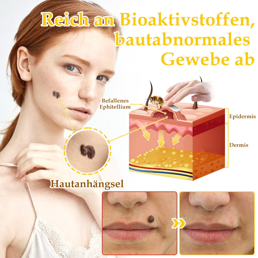 ✅[𝐎𝐟𝐟𝐢𝐳𝐢𝐞𝐥𝐥𝐞𝐫 𝐋𝐚𝐝𝐞𝐧]:5 Tage zu makelloser Haut 👍 𝑺𝑷𝒁𝑽™𝑩𝒊𝒆𝒏𝒆𝒏𝒈𝒊𝒇𝒕 𝑴𝒂𝒖𝒍𝒘𝒖𝒓𝒇 & 𝑾𝒂𝒓𝒛𝒆 𝑬𝒏𝒕𝒇𝒆𝒓𝒏𝒖𝒏𝒈 𝑪𝒓𝒆𝒎𝒆 (𝐄𝐧𝐣𝐨𝐲 𝟑𝟎% 𝐨𝐟𝐟 𝐧𝐨𝐰! 𝐋𝐢𝐦𝐢𝐭𝐞𝐝 𝐭𝐢𝐦𝐞 𝐨𝐟𝐟𝐞𝐫!)