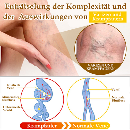 ✅[𝐎𝐟𝐟𝐢𝐳𝐢𝐞𝐥𝐥𝐞𝐫 𝐋𝐚𝐝𝐞𝐧]:5 Tage zu makelloser Haut 👍 𝑺𝑷𝒁𝑽™𝑩𝒊𝒆𝒏𝒆𝒏𝒈𝒊𝒇𝒕 𝑴𝒂𝒖𝒍𝒘𝒖𝒓𝒇 & 𝑾𝒂𝒓𝒛𝒆 𝑬𝒏𝒕𝒇𝒆𝒓𝒏𝒖𝒏𝒈 𝑪𝒓𝒆𝒎𝒆 (𝐄𝐧𝐣𝐨𝐲 𝟑𝟎% 𝐨𝐟𝐟 𝐧𝐨𝐰! 𝐋𝐢𝐦𝐢𝐭𝐞𝐝 𝐭𝐢𝐦𝐞 𝐨𝐟𝐟𝐞𝐫!)