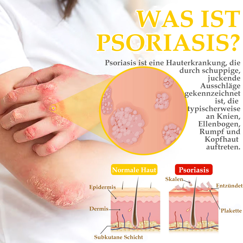 ✅[𝐎𝐟𝐟𝐢𝐳𝐢𝐞𝐥𝐥𝐞𝐫 𝐋𝐚𝐝𝐞𝐧]:5 Tage zu makelloser Haut 👍 𝑺𝑷𝒁𝑽™𝑩𝒊𝒆𝒏𝒆𝒏𝒈𝒊𝒇𝒕 𝑴𝒂𝒖𝒍𝒘𝒖𝒓𝒇 & 𝑾𝒂𝒓𝒛𝒆 𝑬𝒏𝒕𝒇𝒆𝒓𝒏𝒖𝒏𝒈 𝑪𝒓𝒆𝒎𝒆 (𝐄𝐧𝐣𝐨𝐲 𝟑𝟎% 𝐨𝐟𝐟 𝐧𝐨𝐰! 𝐋𝐢𝐦𝐢𝐭𝐞𝐝 𝐭𝐢𝐦𝐞 𝐨𝐟𝐟𝐞𝐫!)