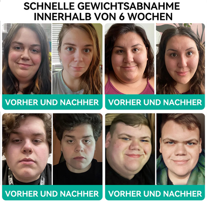 [Empfohlen vom Bundesgesundheitsamt]👩‍⚕️🥇𝑭𝑨𝑻𝑶𝑵𝑮® 𝑺𝑴𝑮𝑻-𝑮𝑳𝑷-1 𝑵𝒂𝒏𝒐𝒎𝒊𝒌𝒓𝒐𝒏𝒂𝒅𝒆𝒍-𝑨𝒃𝒏𝒆𝒉𝒎𝒑𝒇𝒍𝒂𝒔𝒕𝒆𝒓 (Schmerzlos, langanhaltend, zur Behandlung von Diabetes, Fettleibigkeit und Herz-Kreislauf-Erkrankungen
